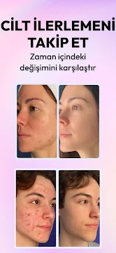 Ekran Görüntüsü 5